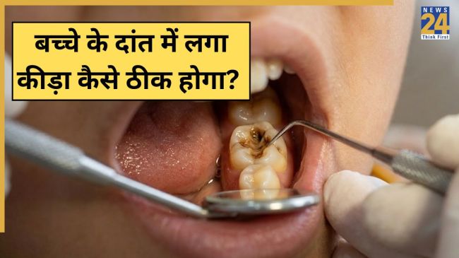 Bache Ke Dant Me Kida