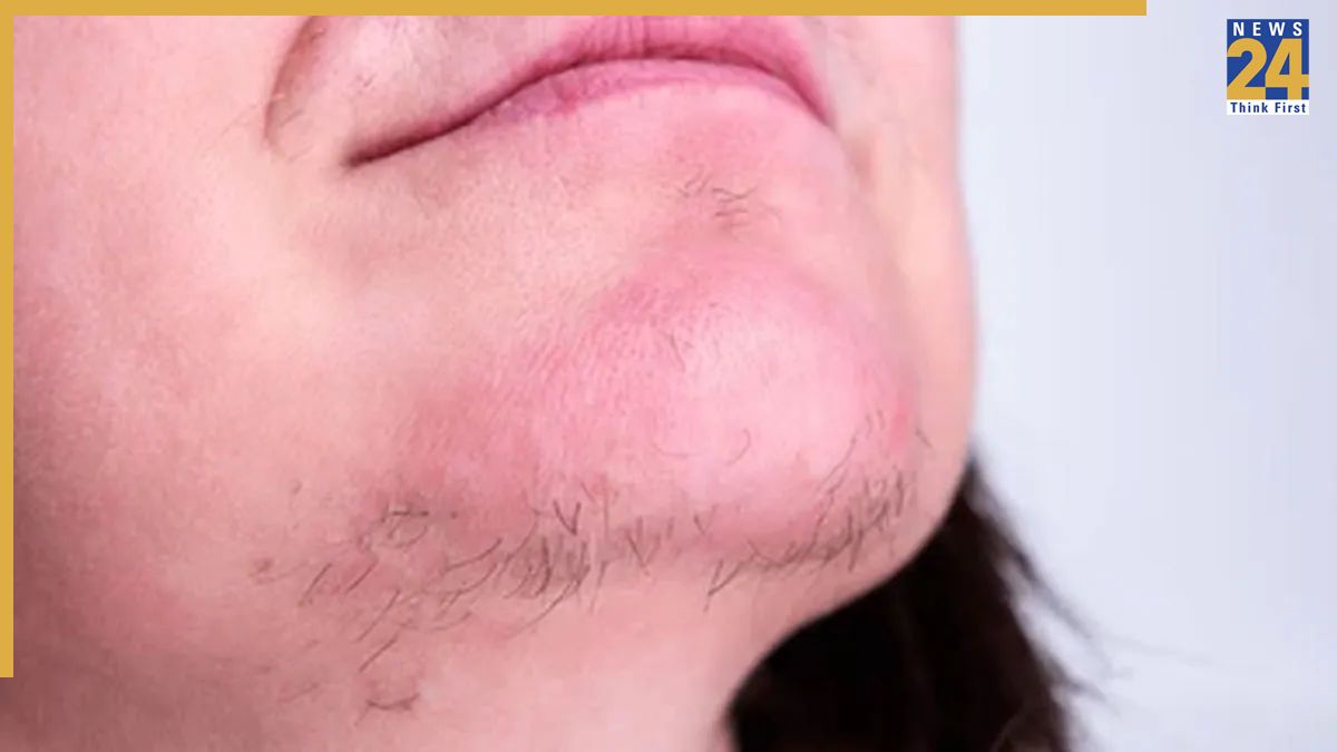 Bimari Hone Par Sharir Mein Hone Wale Badlav-1