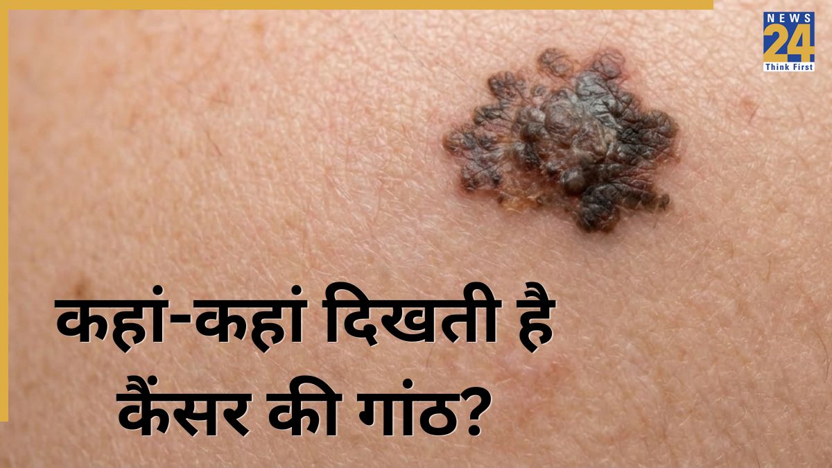 Cancer Lumps Symptoms-1