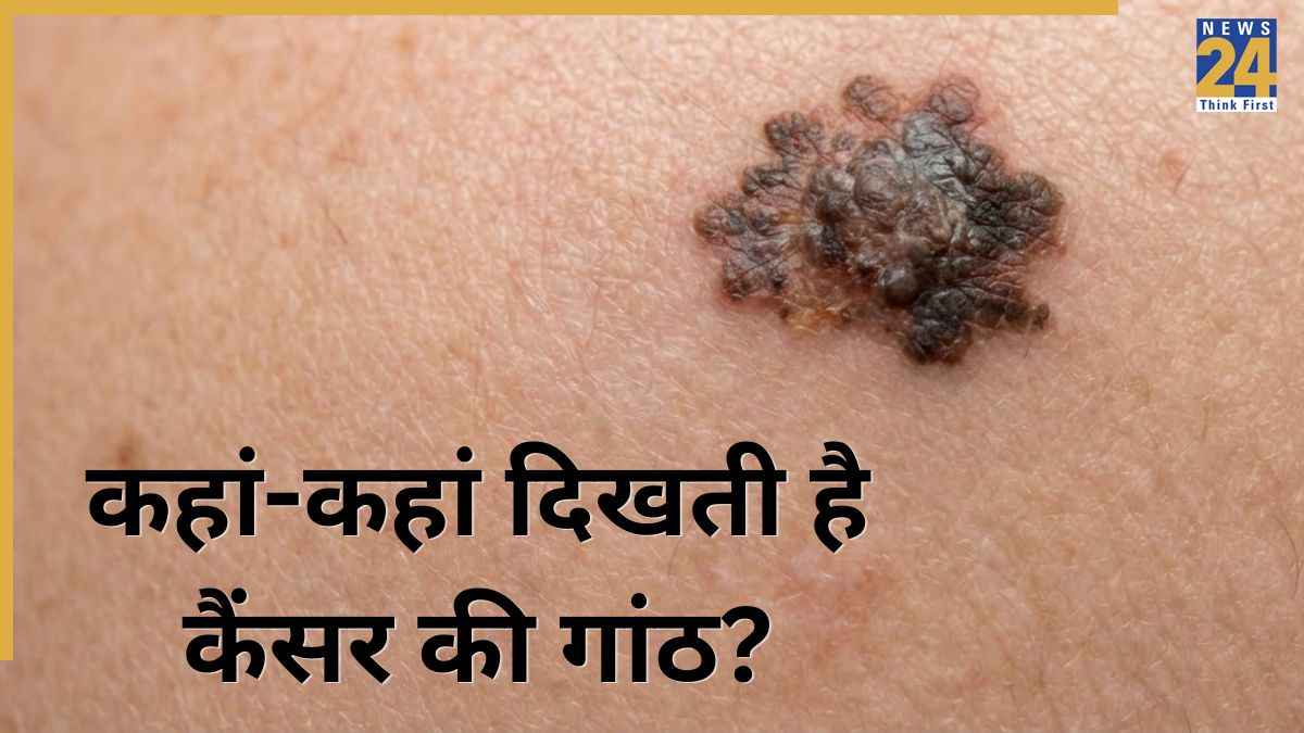 Cancer Lumps Symptoms
