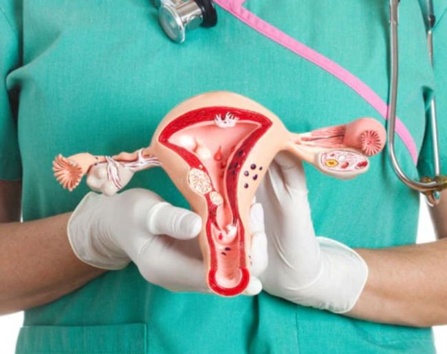 Cervical Cancer Kaise Hota Hai-1-2