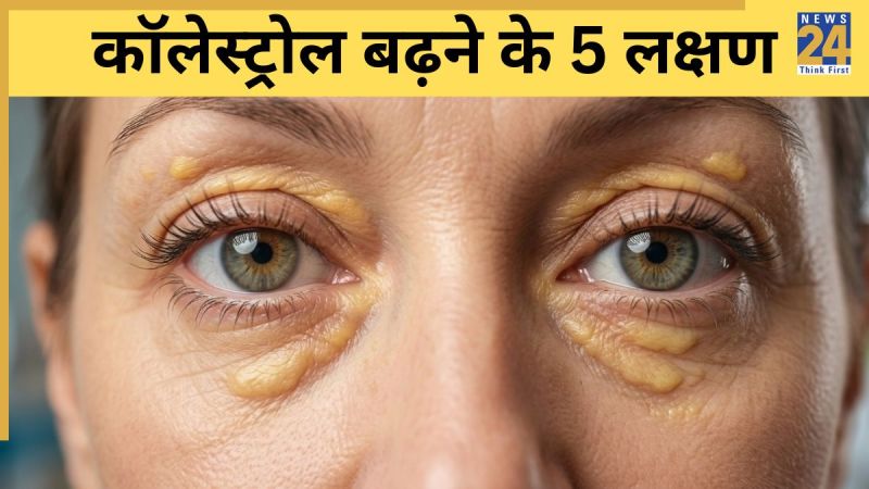 Cholesterol Badhne Ke Lakshan High Cholesterol Symptoms