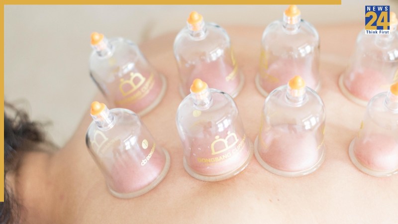 Cupping Therapy