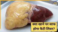 Foods For Fatty Liver