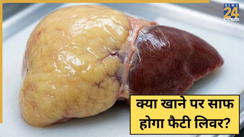 Foods For Fatty Liver