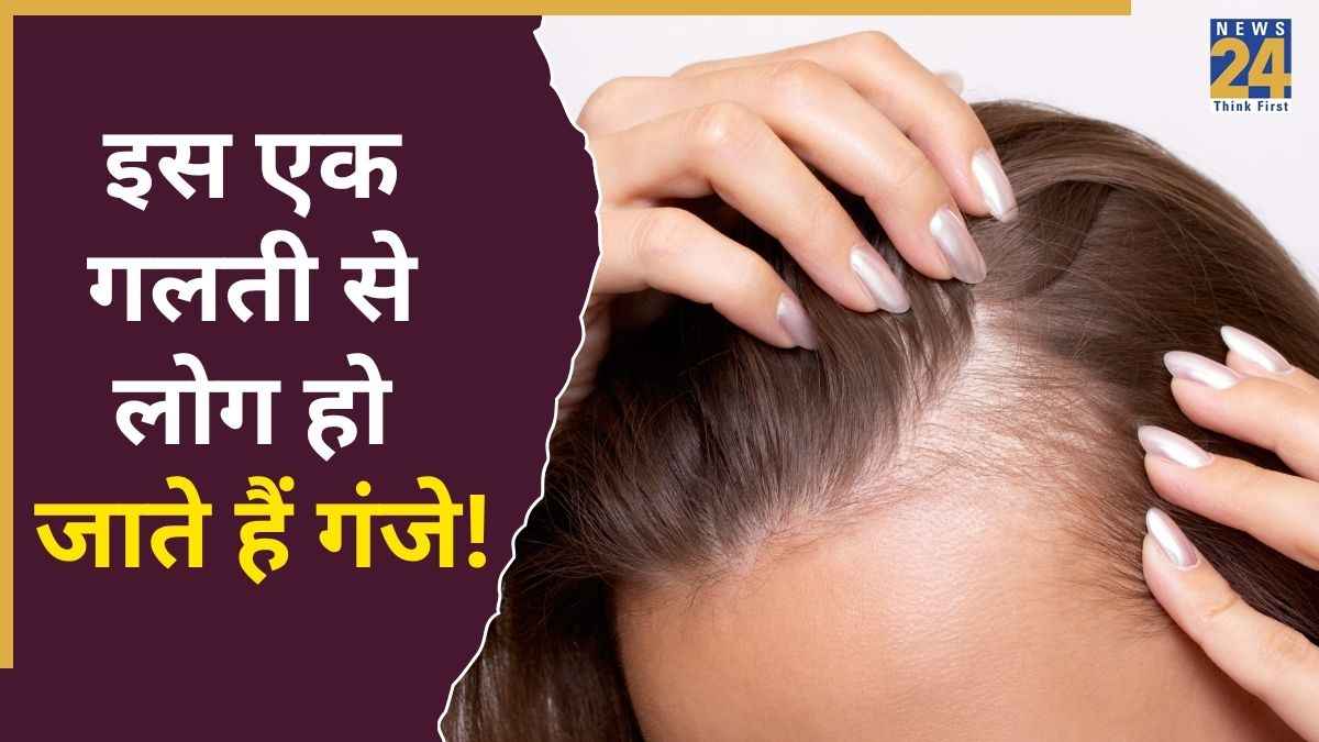 इस एक गलती की वजह से आप भी हो सकते हैं गंजे, डॉक्टर ने कहा भूल से भी इग्नोर ना करें यह साइन