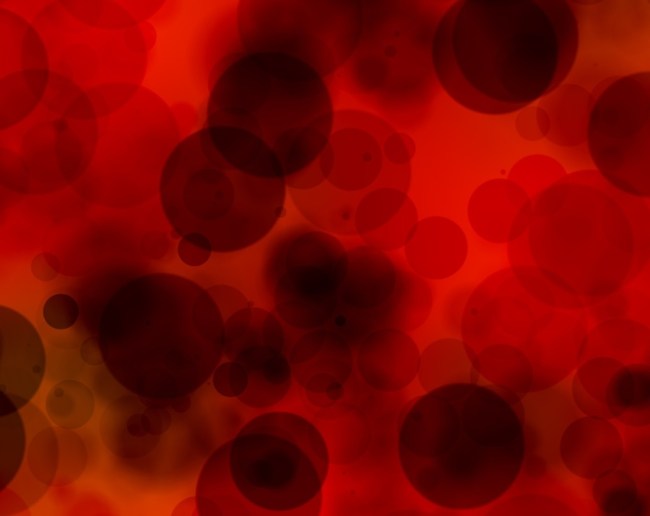 Heart Blockage-1-2-3-4-5-6-7