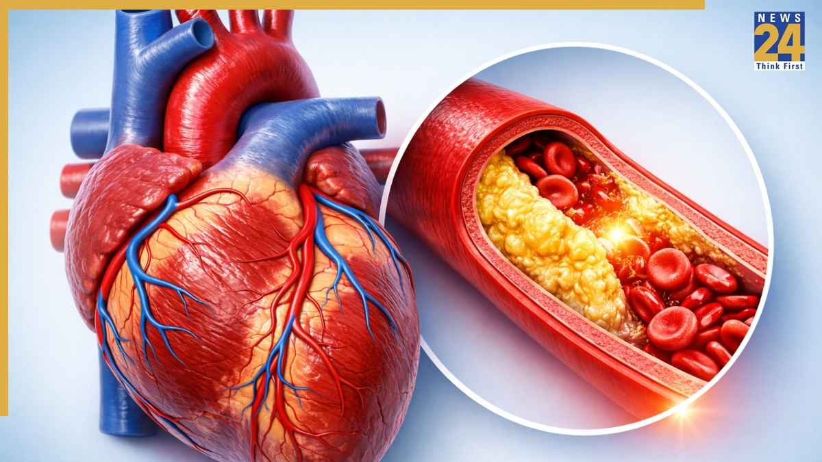 Heart Blockage
