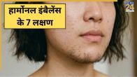 Hormonal Imbalance Signs