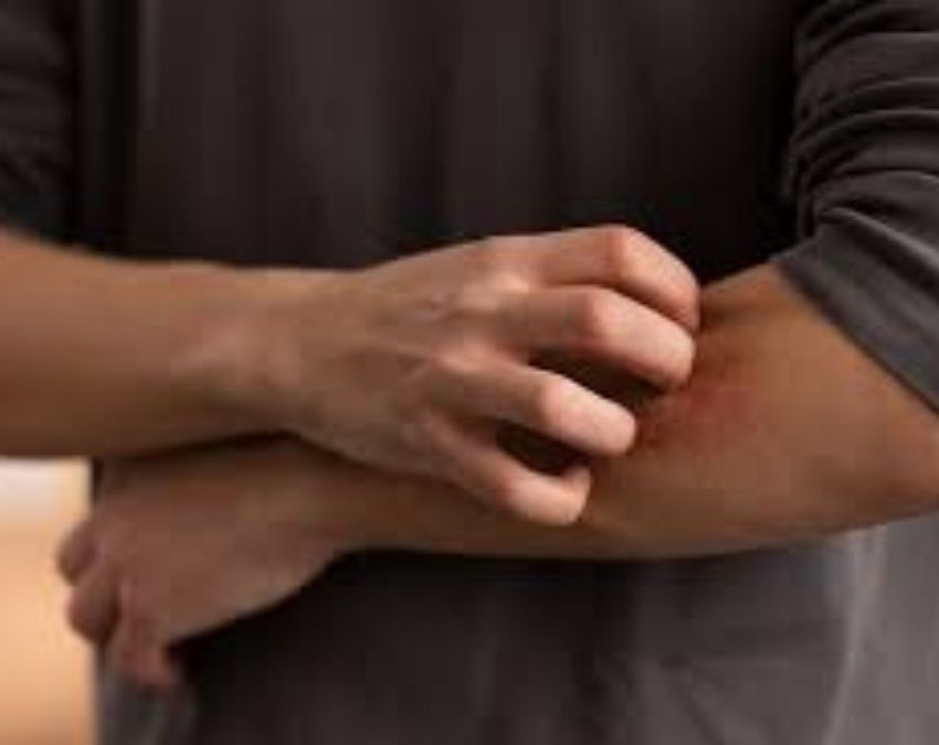 Kidney ki Bimari Me Khujli Hona-1-2-3-4-5