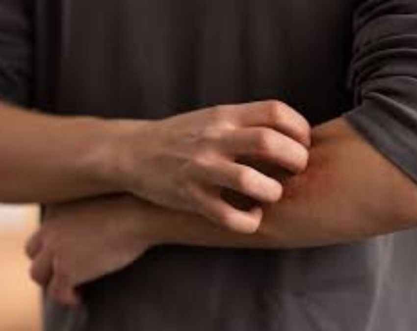 ड्राई स्किन की वजह 