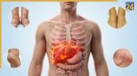 Liver Damage Symptoms