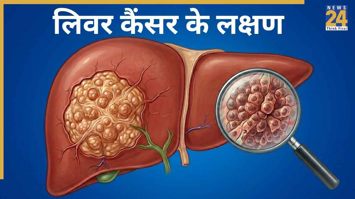 Liver Cancer Symptoms