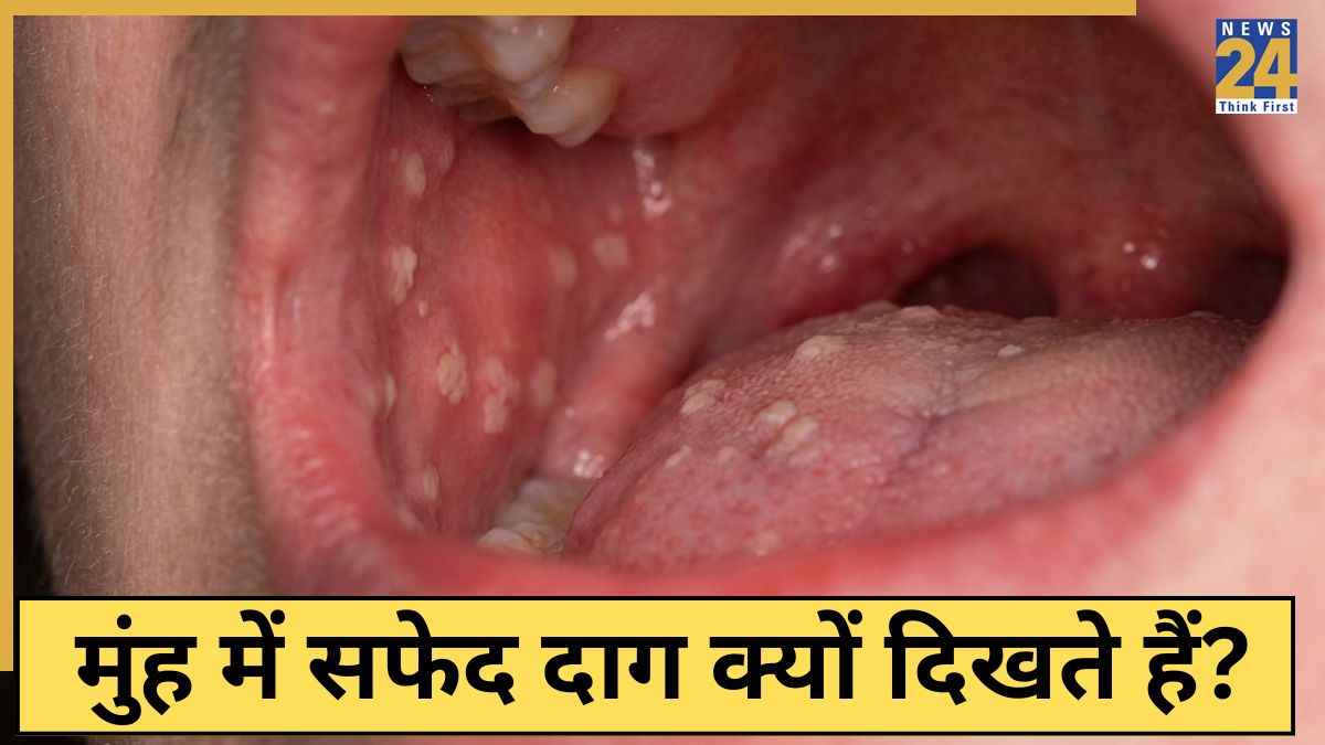 Muh Ke Cancer Ke Lakshan