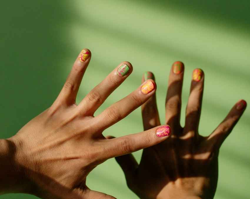 सफेद निशान क्या हैं?