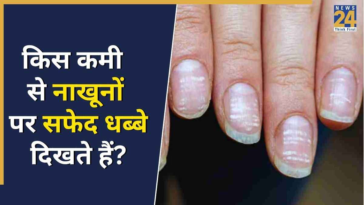 नाखूनों पर सफेद धब्बे किस कमी की वजह से होते हैं? यहां जानिए कैसे दूर होगी दिक्कत