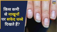 White Spots On Nails