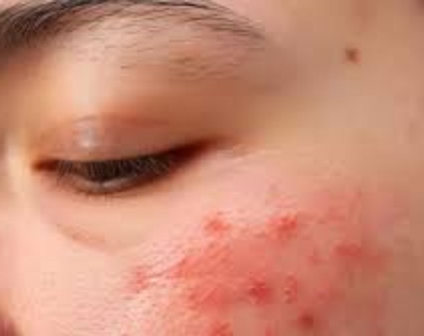 Gaal Mein Dard Hona-1-2-3-4-5