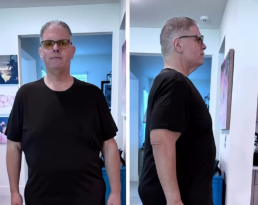 Weight Loss Story-1-2