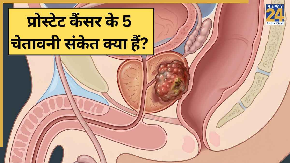 warning signs of prostate cancer