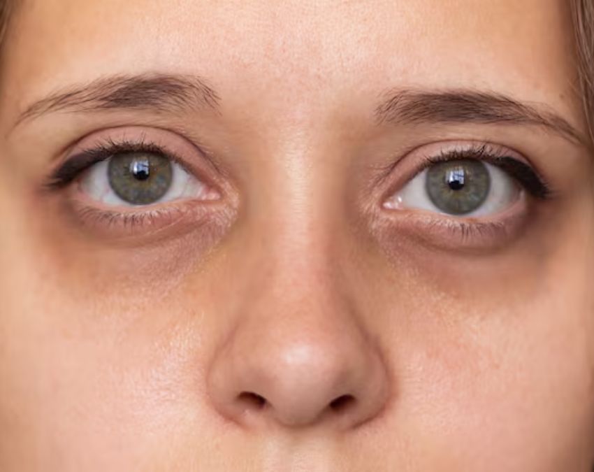 Rozana Ek Momo Khane Se Kya Hoga Rozana Ek Momo Khane Se Kya Hoga-1-2-3-4