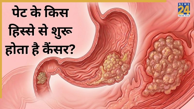 Stomach Cancer Symptoms Stomach Cancer Symptoms-1