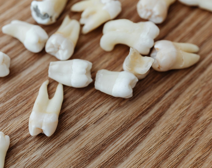 Strong Teeth Comparison-1-2-3