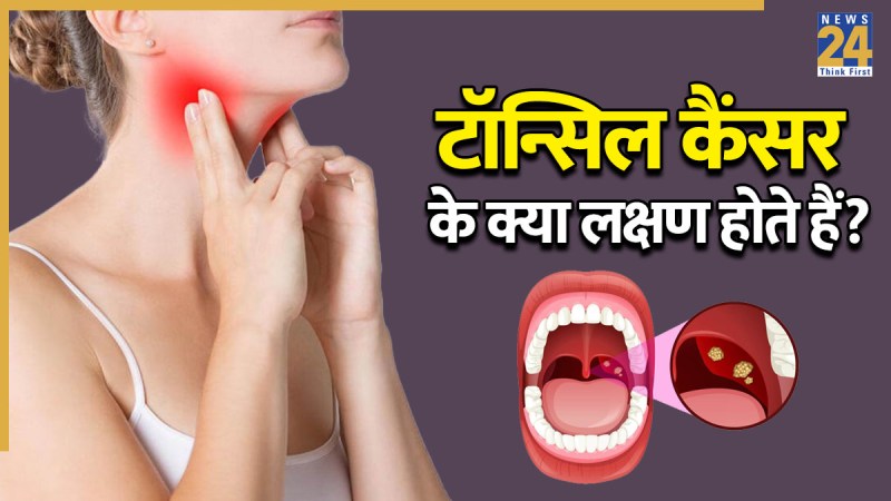 Tonsil cancer symptoms