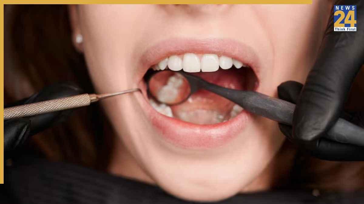 दातों में कीड़ा लग जाए तो क्या करें? डॉक्टर के बताए इस नुस्खे से सिर्फ 2 दिन में नजर आएगा फर्क