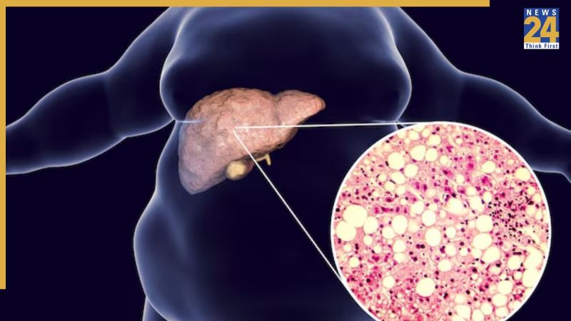 Liver Kharab Hone Ke Sanket