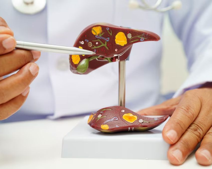 fatty liver test-1-2-3-4-5-6