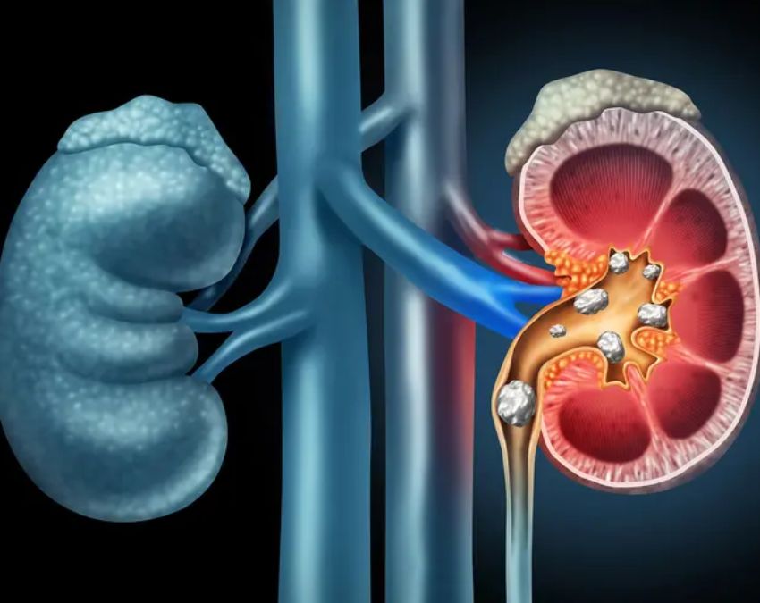 Kidney ki Bimari Me Khujli Hona-1-2