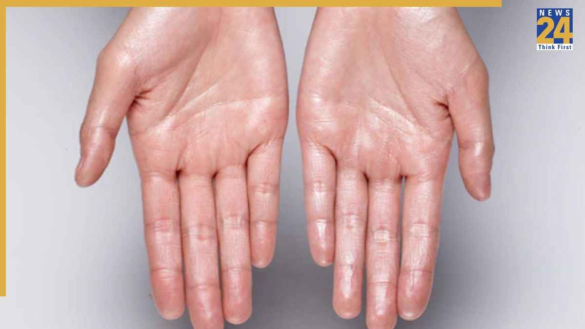 Soft Hand Home remedies