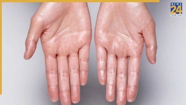 Soft Hand Home remedies Soft Hand Home remedies