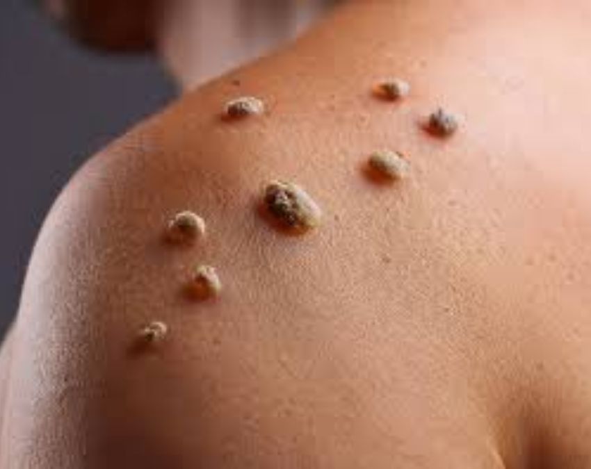 Gale Par Masse Hona-1-2-3