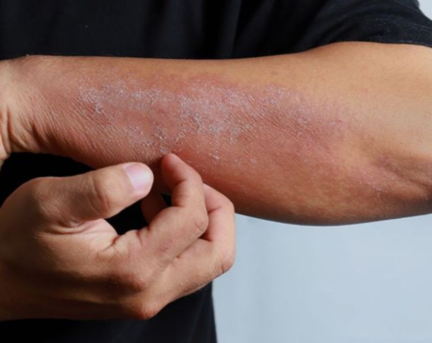 Is Hair Extension Cause Of Breast Cancer-1-2-3