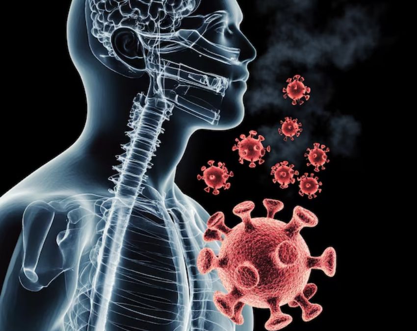 Tuberculosis prevention Tuberculosis prevention-1-2-3-4