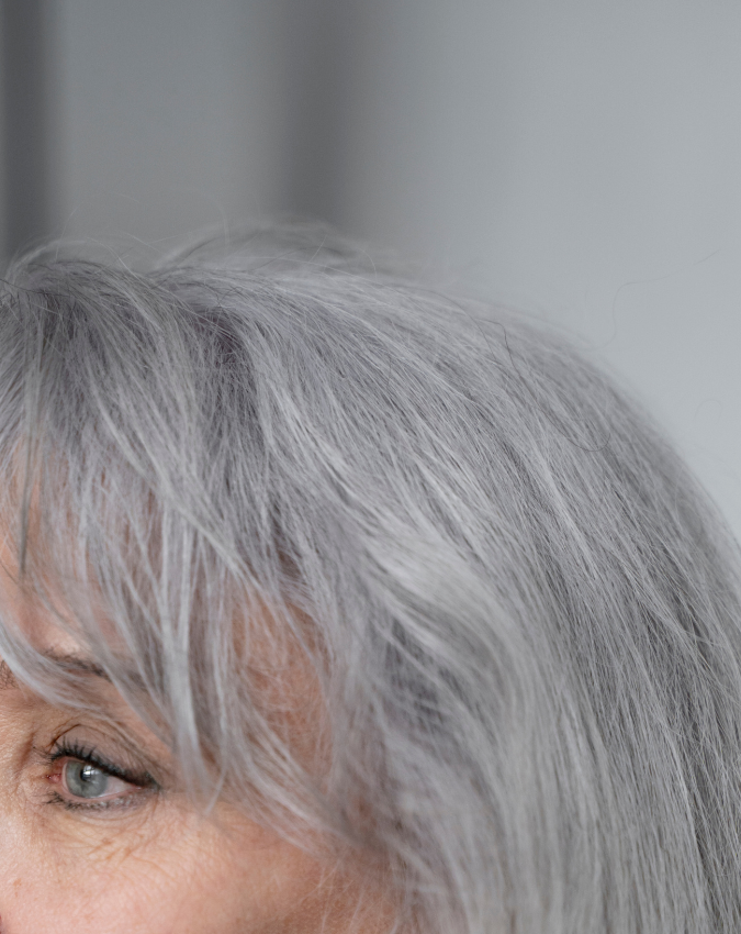 White Hair Causes-1-2