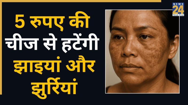 Wrinkles and pigmentation