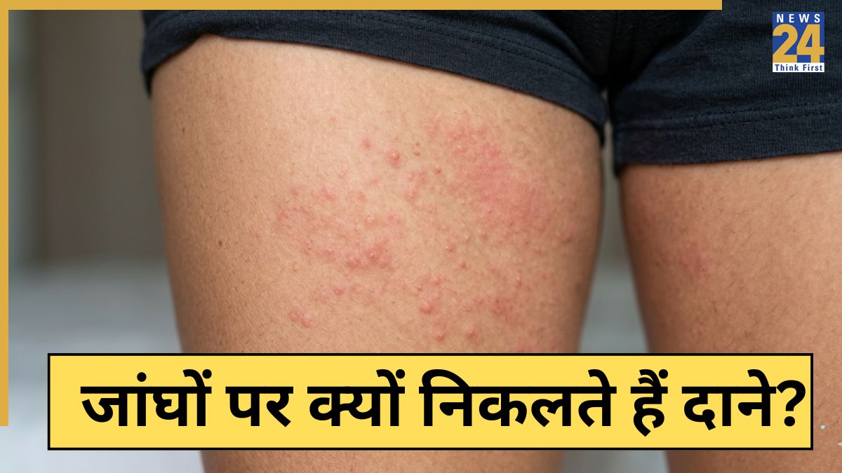 Rash And Bumps On Inner Thigh-1