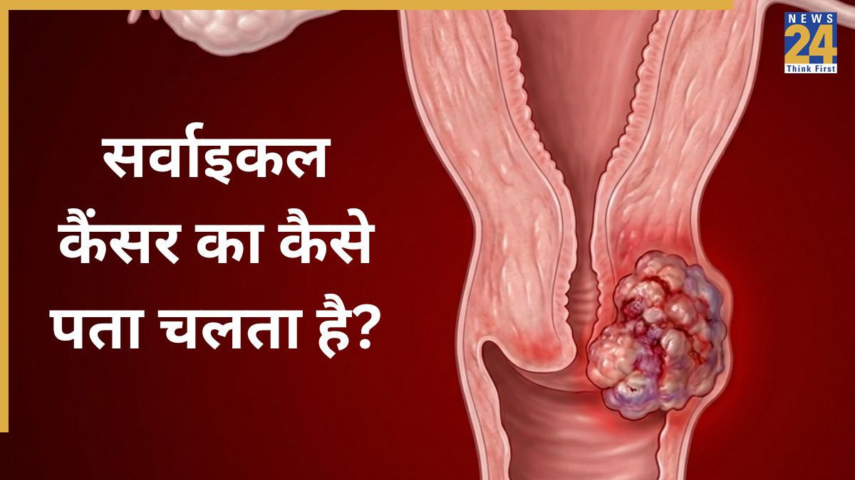 cervical cancer test cervical cancer test-1
