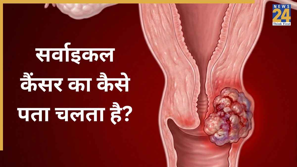 cervical cancer test