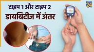 Type 1 And 2 Diabetes Difference
