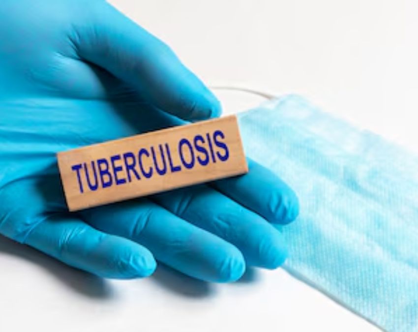 Tuberculosis prevention Tuberculosis prevention-1-2-3