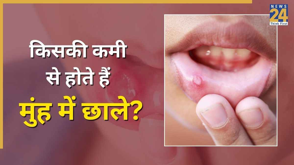Mouth Ulcer Causes