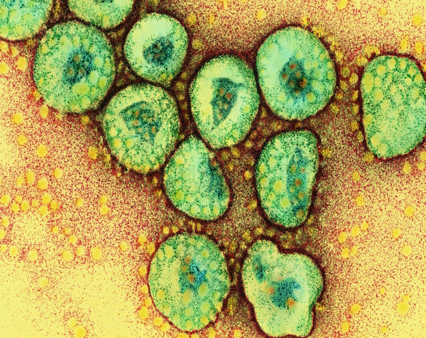 new COVID variant-1-2-3-4