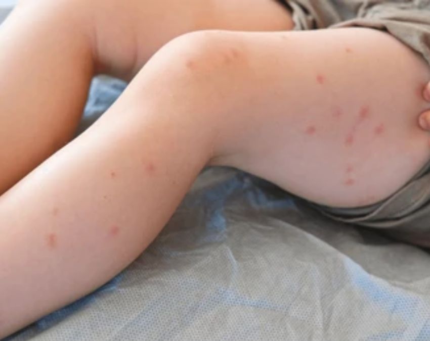 Early Sign Of Bone Cancer-1-2-3-4-5-6