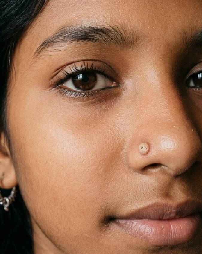 नाक की नोक पर मस्सा