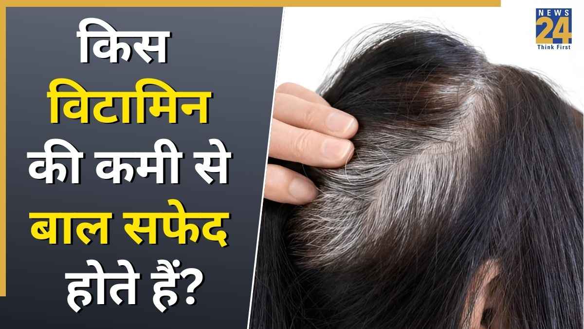 White Hair Causes