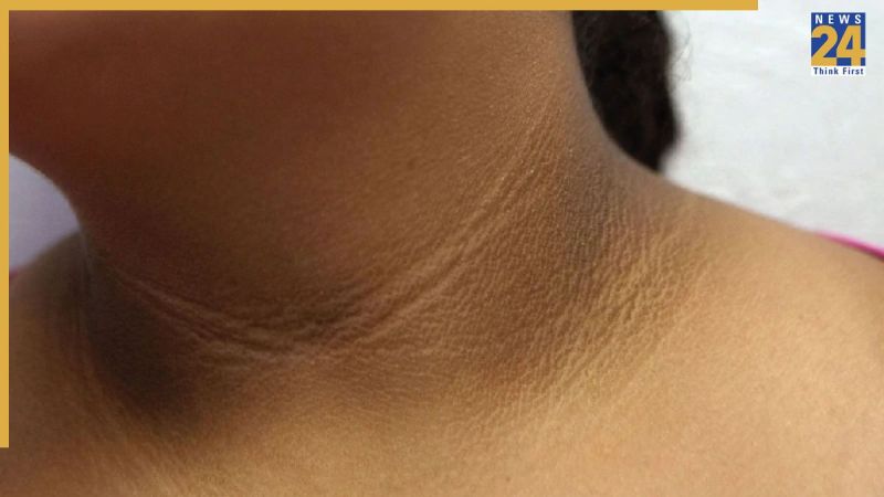 Kali Gardan Saaf Karne Ka Tarika